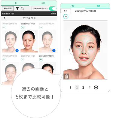 過去の肌診断画像と比較